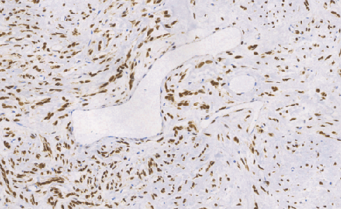 兔抗人STAT6单克隆抗体  TDCSR-0281