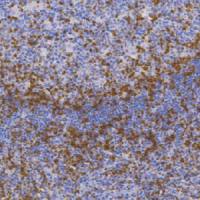 鼠抗人ZAP-70单克隆抗体  TDCZM-0010