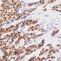 鼠抗人孕激素受体单克隆抗体  TDCPM-0365