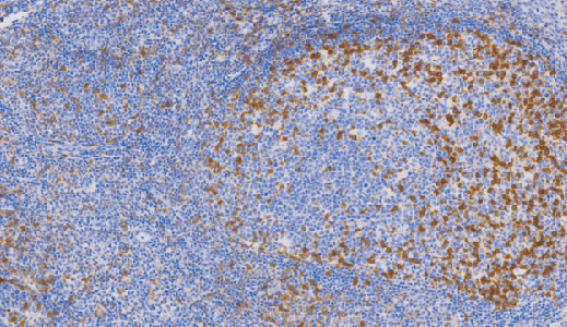 鼠抗人PD1单克隆抗体 TDCPM-0270