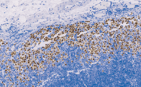 兔抗人神经（管）嵴转录因子10单克隆抗体  TDCSR-01