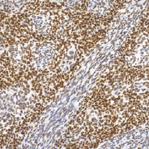 鼠抗人TLE1单克隆抗体   TDCTM-0170