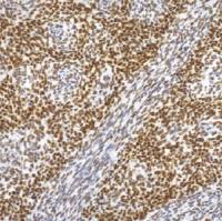 鼠抗人TLE1单克隆抗体   TDCTM-0170