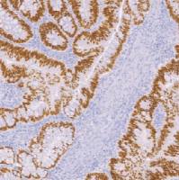 兔抗人SATB2单克隆抗体  TDCSR-0140