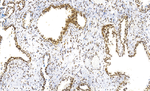 鼠抗人增殖细胞核抗原单克隆抗体 TDCPM-0260