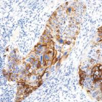 鼠抗人TAG-72单克隆抗体 TDCTM-0110