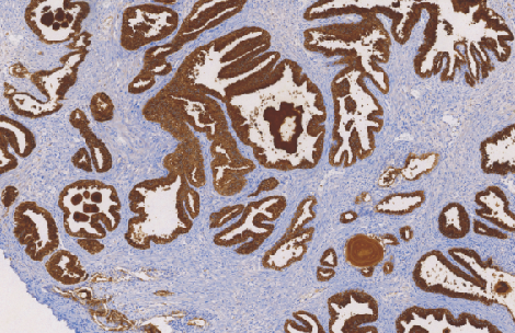 鼠抗人前列腺特异性抗原单克隆抗体  TDCPM-0404