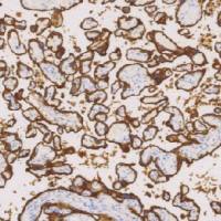 鼠抗人胎盘碱性磷酸酶单克隆抗体  TDCPM-0311