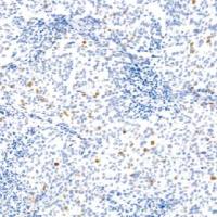 兔抗人PHH3多克隆抗体