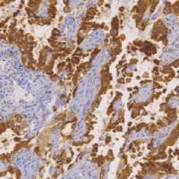 兔抗人ROS1单克隆抗体 TDCRR-0040