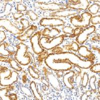 鼠抗人琥珀酸脱氢酶复合体亚基B单克隆抗体  TDCSM-0270