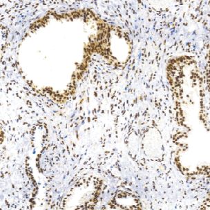 鼠抗人增殖细胞核抗原单克隆抗体  TDCPM-0260