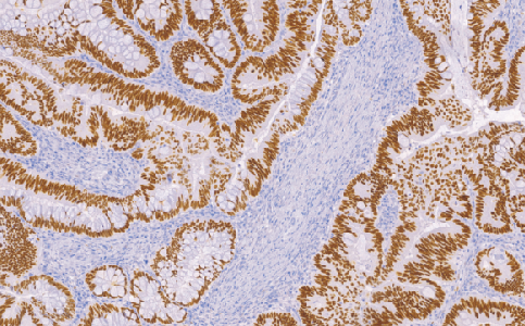 兔抗人SATB2单克隆抗体  TDCSR-0140