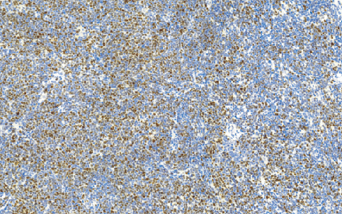 鼠抗人神经（管）嵴转录因子11单克隆抗体  TDCSM-01