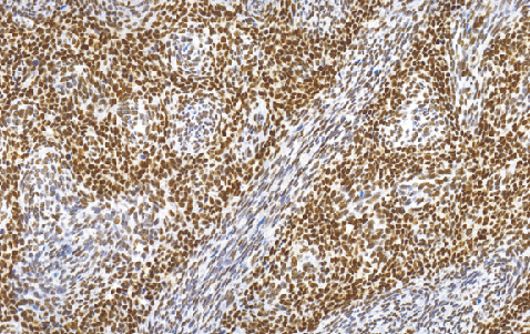 鼠抗人TLE1单克隆抗体   TDCTM-0170