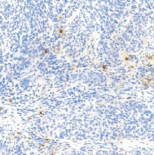 鼠抗人类胰蛋白酶单克隆抗体  TDCTM-0200