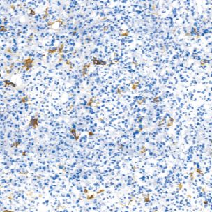 兔抗人催乳素单克隆抗体   TDCPR-0371