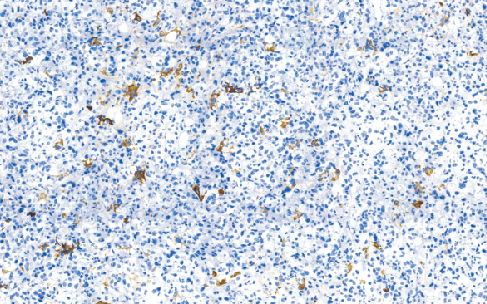 兔抗人催乳素单克隆抗体 TDCPR-0371