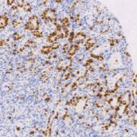 兔抗人拓扑异构酶 Ⅱ α单克隆抗体  TDCTR-0231