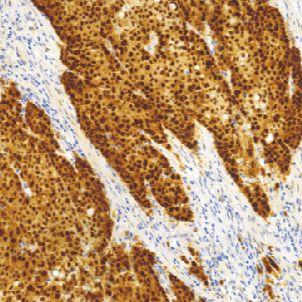 兔抗人神经（管）嵴转录因子9单克隆抗体  TDCSR-0300