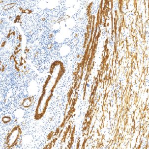 鼠抗人平滑肌肌动蛋白单克隆抗体   TDCAM-0191
