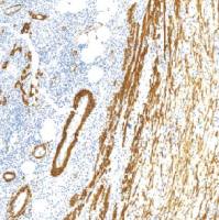 鼠抗人平滑肌肌动蛋白单克隆抗体 TDCAM-0191