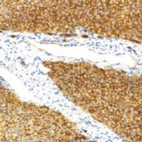 兔抗人CD13单克隆抗体 TDCCR-0411