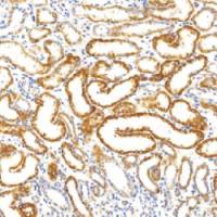 鼠抗人琥珀酸脱氢酶复合体亚基B单克隆抗体  TDCSM-0270