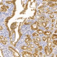 兔抗人BRAF V600E 单克隆抗体  TDCBR-0100