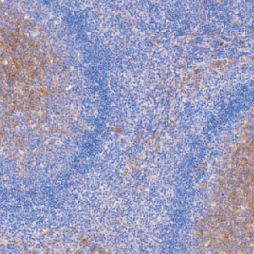 兔抗人CD14单克隆抗体  TDCCR-0420