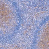 兔抗人CD14单克隆抗体 TDCCR-0420