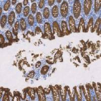 兔抗人钙粘附蛋白17单克隆抗体  TDCCR-0181