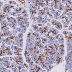 鼠抗人消化道癌抗原单克隆抗体  TDCCM-0170