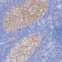 兔抗人Bcl-6癌基因蛋白单克隆抗体 TDCBR-0051