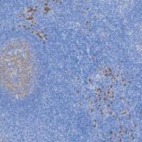 鼠抗人CD15单克隆抗体 TDCCM-0431