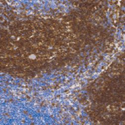 兔抗人CD19单克隆抗体  TDCCR-0452
