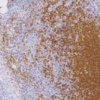 鼠抗人CD20单克隆抗体 TDCCM-0461