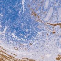 鼠抗人钙调节蛋白单克隆抗体 TDCCM-0213