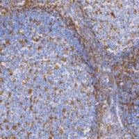 鼠抗人CD11c单克隆抗体  TDCCM-0400