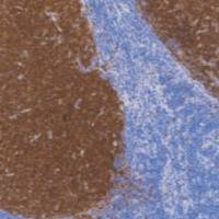 鼠抗人CD10单克隆抗体  TDCCM-0391