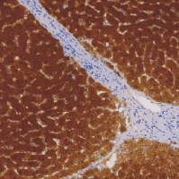 兔抗人精氨酸酶-1单克隆抗体 TDCAR-0231