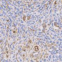 兔抗人钙结合蛋白单克隆抗体 TDCCR-0200