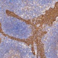 鼠抗人β-连接素单克隆抗体  TDCBM-0031