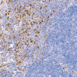 兔抗人CD16单克隆抗体  TDCCR-0441