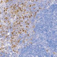 兔抗人CD16单克隆抗体 TDCCR-0441