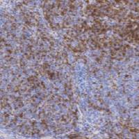 鼠抗人CD1a单克隆抗体  TDCCM-0313