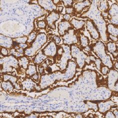 鼠抗人绒毛膜促性腺激素单克隆抗体  TDCHM-0281