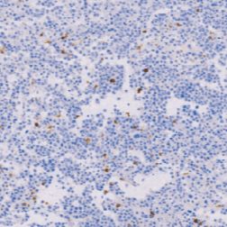 兔抗人髓过氧化物酶多克隆抗体 TDCMR-0211