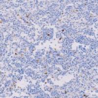 兔抗人髓过氧化物酶多克隆抗体 TDCMR-0211