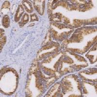 鼠抗人α-甲基酰基辅酶A消旋酶单克隆抗体  TDCAM-0201